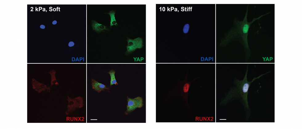 Confocal microscopy images showing fluorescently labelled cells on different substrates. On the left, the 2kPa soft substrate shows cells spreading while on the right a 10 kPa stiff substrate shows no spreading of cells.